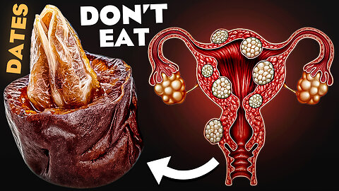 DON'T Eat Eates If You Have These 7 Health Problems! Dates Health Risks