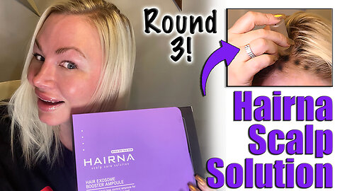 Growing Hair with Hairna Scalp Solution from Maypharm, Round 3| Code Jessica10 saves you Money