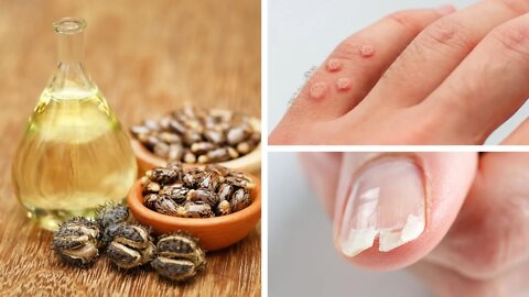 Few People Know These Surprising Castor Oil Uses