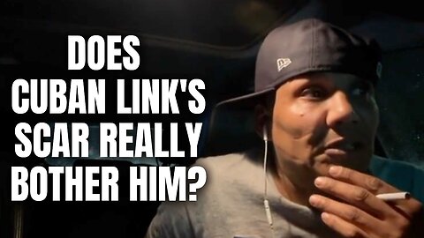 Does Cuban Link's Scar Really Bother Him? [Part 23]
