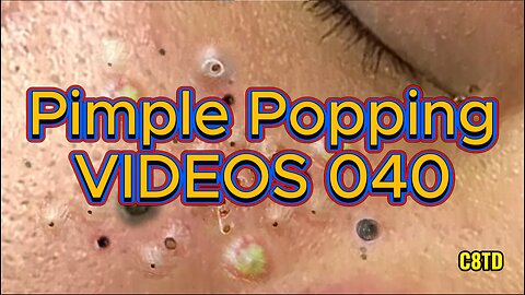 Satisfying Pimple Popping Videos 040