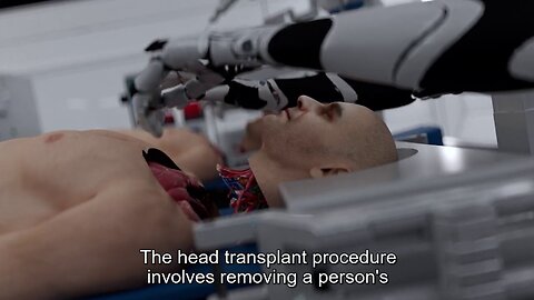 Brain Bridge ~ Head Transplant Machine