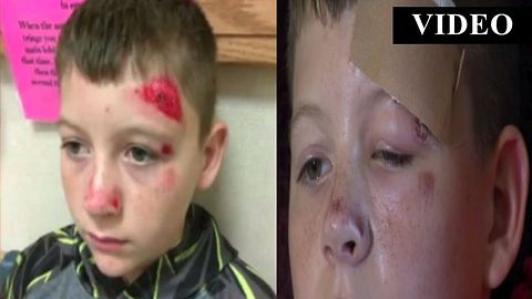 Mom Takes Matters Into Her Own Hands After Her Son Is Continually Bullied At School