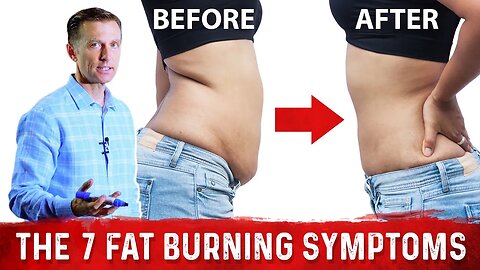 The 7 Signs & Symptoms That Prove You Are Burning Fat – Dr.Berg