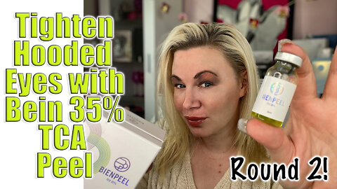 Tighten Hooded Eye Lids with Bein Peel from Acecosm: Round 2 | Code Jessica10 saves YOU Money