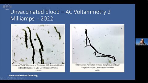 Dr. Ana Mihalcea - WORLD FIRST! Spectrometry of Nano Structures in the Blood