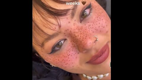 Gen Z Is Now Tattooing Freckles Onto Their Faces