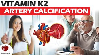 Vitamin K2 and Artery Calcification (Part 2): The Matrix Gla Protein