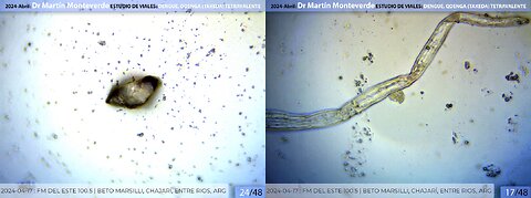 Dr. Martín Monteverde estudio de viales Dengue, QDENGA (TAKEDA) tetravalente 💉💉💉 ｜ Abril 2024