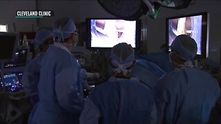 Non-essential surgeries return as COVID-19 cases drop in Ohio