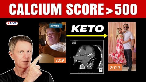 How To Do Keto To Burn Fat, Reverse Fatty Liver & Unclog Arteries