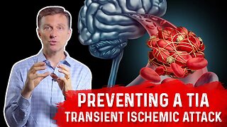 How To Prevent TIA (Transient Ischemic Attack) Mini-Stroke? – Dr.Berg