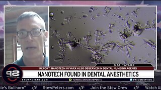 Nanotech Found In Dental Anesthetics: Nanotech Found In Vaxx Also Observed In Dental Drugs