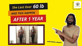 She Lost Over 60lb And This Happen After 1 Year
