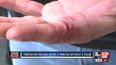 Tampa firefighter brought back to life after being electrocuted and without pulse for 17 minutes