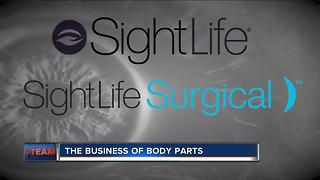 Concerns over changes to organ donation in WI