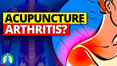 Use Acupuncture to Cure Pain in Your Bones and Joints [Arthritis Relief]