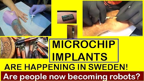 Microchip implants begin in Sweden