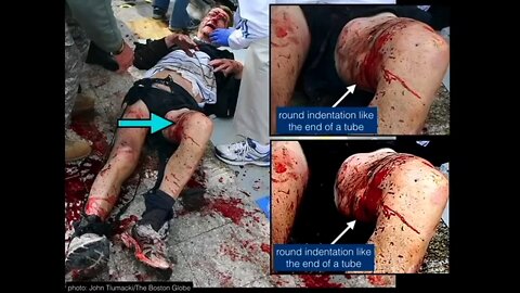 HOW AND WHY THE BOSTON MARATHON BOMBING WAS A STAGED FALSE FLAG EVENT