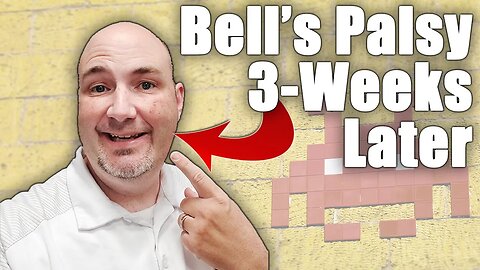 3-Weeks Post Bell's Palsy Diagnosis Update - Our Path Towards Recovery