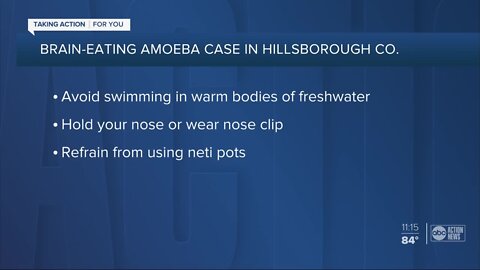 DOH confirms case of rare brain-eating amoeba in Hillsborough County