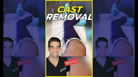 Cast Removal for Broken Ankle