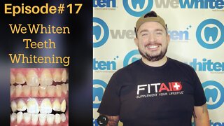 WeWhiten Teeth Whitening Review