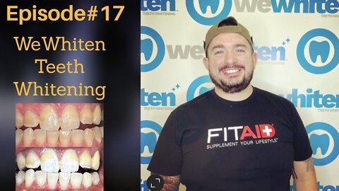 WeWhiten Teeth Whitening Review