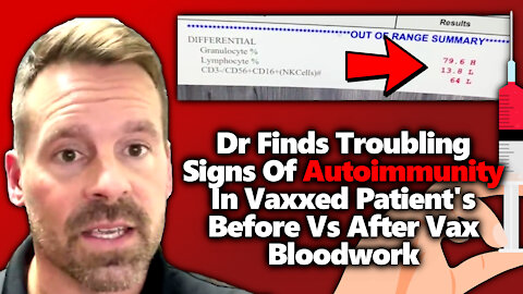 Autoimmunity? Dr Nathan Thompson Shares Concerning Results From Vaxxed Patient Tested Before Vs Afte