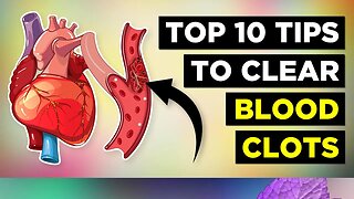 10 Tips To Clear Blood Clots (Naturally)