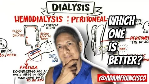 Hemodialyis vs Peritoneal Dialysis (pros & cons)