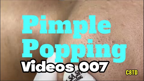 Satisfying Pimple Popping Videos 007