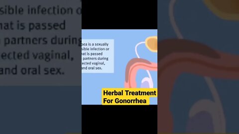 GONORRHEA MALE/FAMALE. herbal medicine kill gonorrhea in just 14 days use Dr Etiko herbs