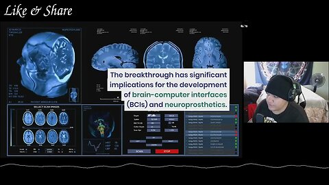 Non Invasive Brain Imaging Deciphers Hand Gestures 🪙 Pure EnigMᐰh 🐀