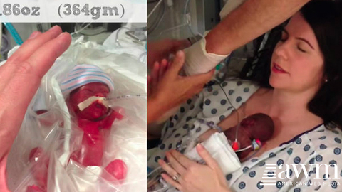 Dad Films Moment When Mom Gets To Hold Her Preemie For The First Time, Goes Viral
