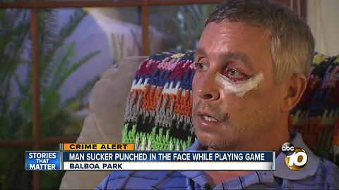 Man sucker punched in the face at Balboa Park