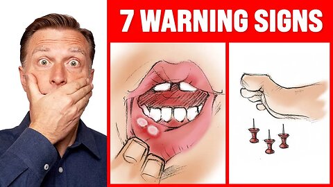 The 7 WARNING Signs of a B12 Deficiency - Dr. Berg