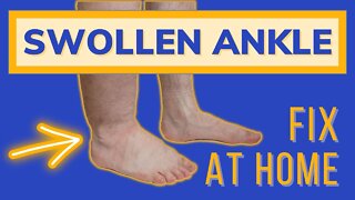 Swollen Painful Ankles Treatment At Home; Do It Right!!