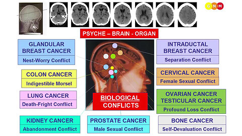 RICHPLANET Show 280: Dr. Ryke Geerd Hamer and the Psychological Link of Cancer