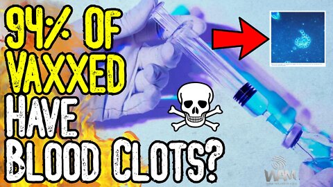 Study: 94% Of VAXXED Have PRE-BLOOD CLOT FORMATIONS! - Shocking Evidence EXPOSED!