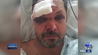 Family of hit and run victim speaks with Denver7 about troubles following victim's death