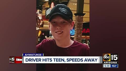 Hit and run driver leaves teen hospitalized