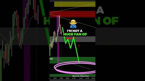 This Mistake will SAVE you Money in Trading.. 💸