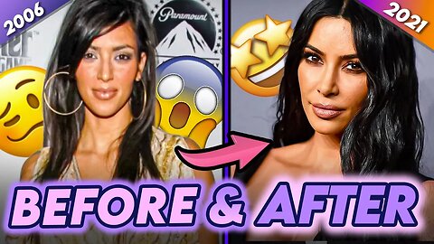 Kim Kardashian | Before & After | History Of Her Plastic Surgeries