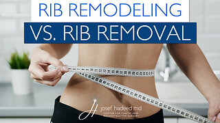 Rib Remodeling vs Rib Removal