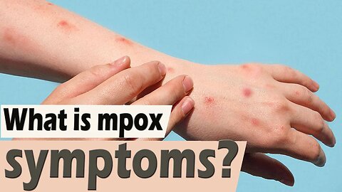 What is mpox symptoms? What causes mpox positive?