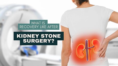 What Is Recovery Like After Kidney Stone Surgery?