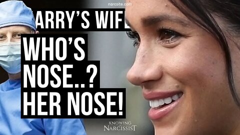 Harry´s Wife 102.88 Who Nose? Her Nose (Meghan Markle)
