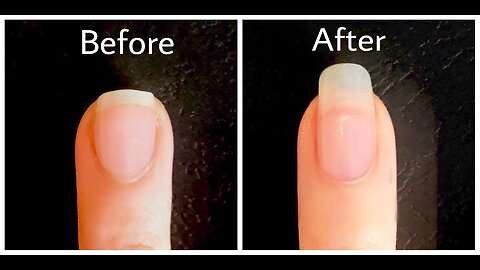 The best product ProNail Complex for nail growth