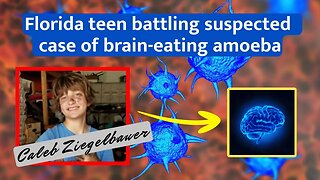 Florida teen Caleb Ziegelbauer battling suspected case of brain-eating amoeba for over 50 days #news